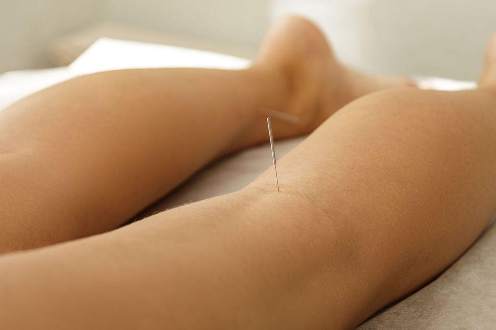 acupuncture-jambes.jpg